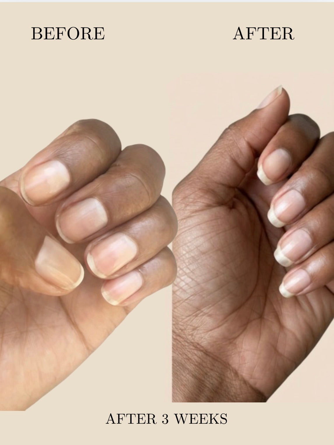 THE NAIL OIL